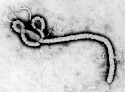 Ebola Hemorrhagic Fever Virus