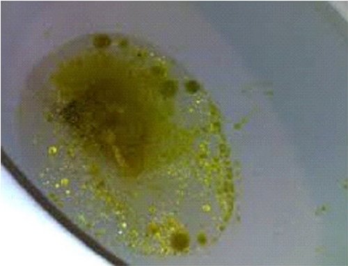 The water inside the bowl has drops of oil, which is one of the symptoms of steatorrhea image photo picture