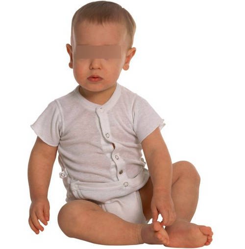 White diarrhea can also affect the children, especially the infants image photo picture