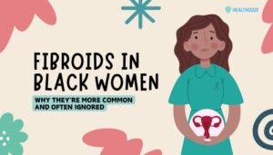 Fibroids in Black Women- Why They’re More Common and Often Ignored