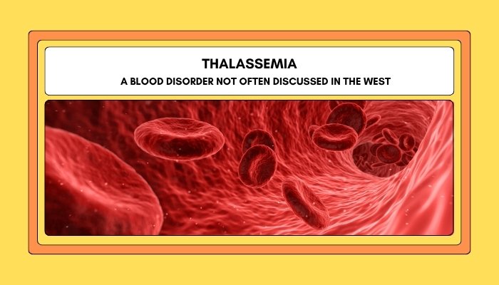 Thalassemia- A Blood Disorder Not Often Discussed in the West