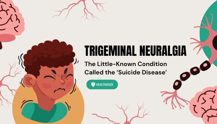 Trigeminal Neuralgia: The ‘Suicide Disease’ That Causes Excruciating Facial Pain