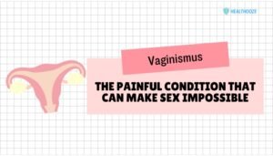 Vaginismus- The Painful Condition That Can Make Sex Impossible