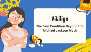 Vitiligo- The Skin Condition Beyond the Michael Jackson Myth